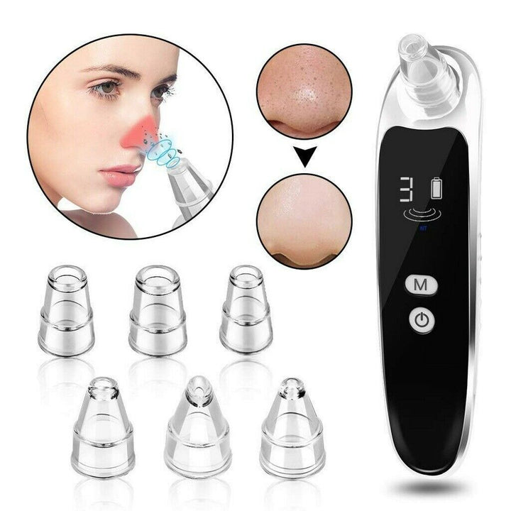 Pore Vacuum Blackhead Remover – Deep Cleansing & Clearer Skin