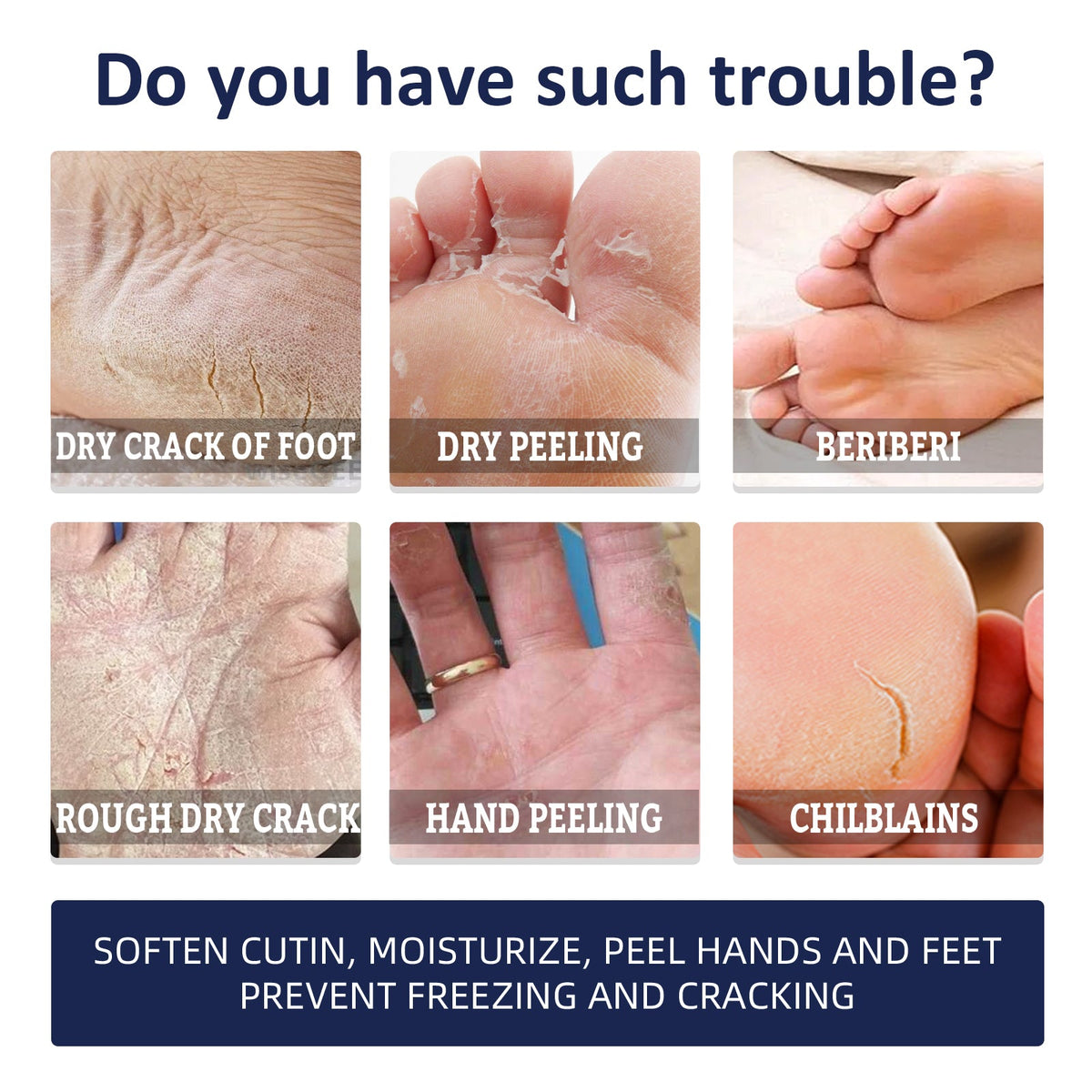 Hand & Foot Repair Cream for Cracked, Rough Skin 30g