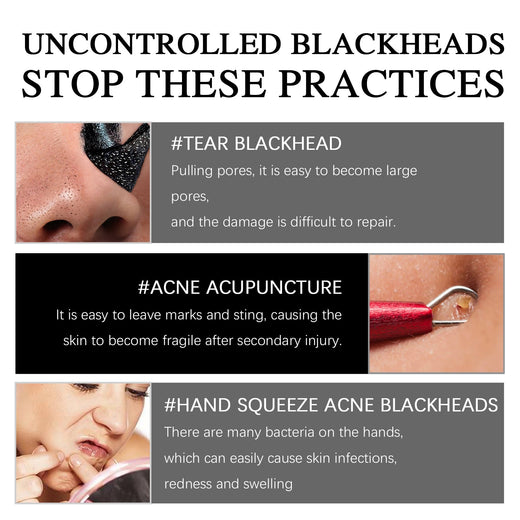 Magnetic Blackhead Mask That Pulls Pore Gunk Out