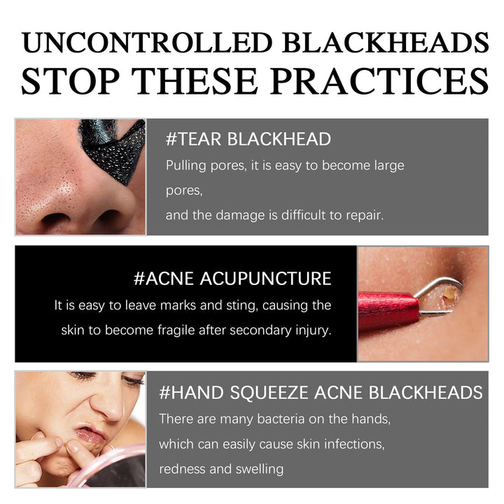Magnetic Blackhead Mask That Pulls Pore Gunk Out