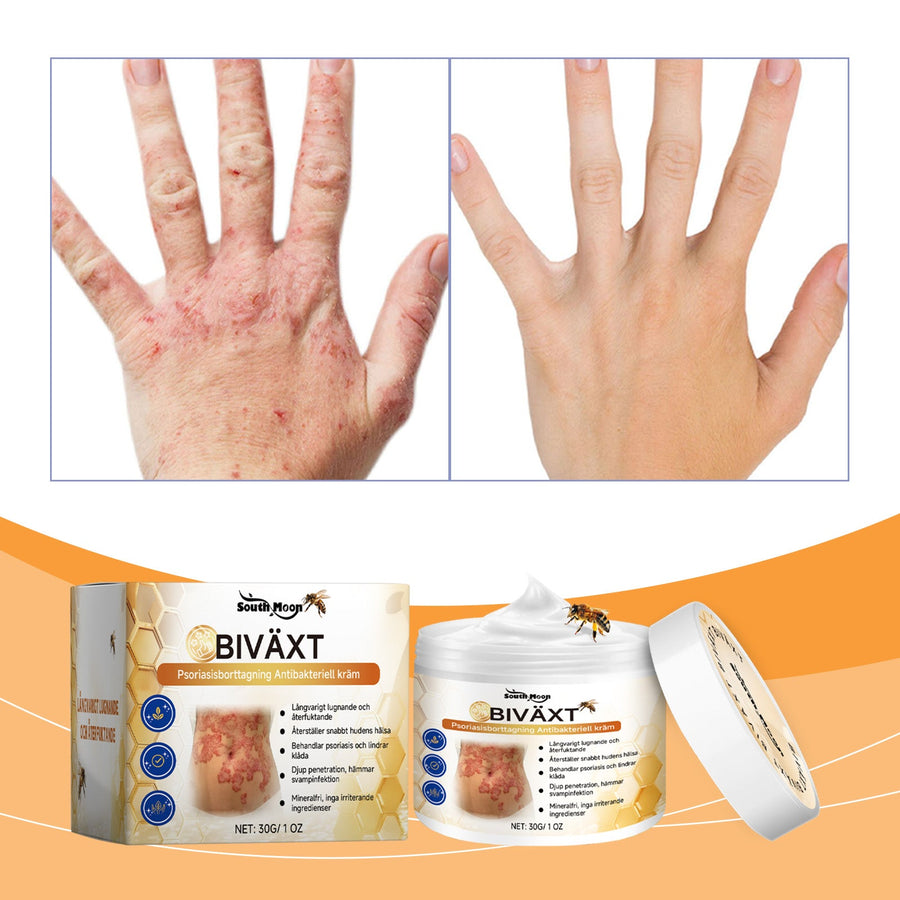 Herbal Repair Cream for Psoriasis & Eczema Relief