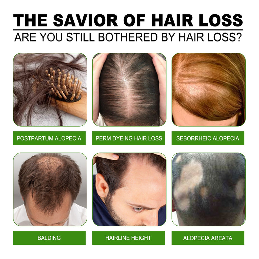 Scalp Hair Growth Spray for Thinning Hair Support
