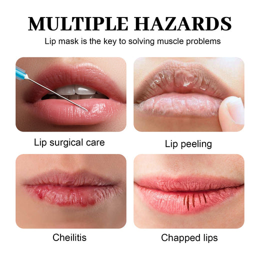 Marine Collagen Lip Mask for Dry, Cracked Lips (16pk)
