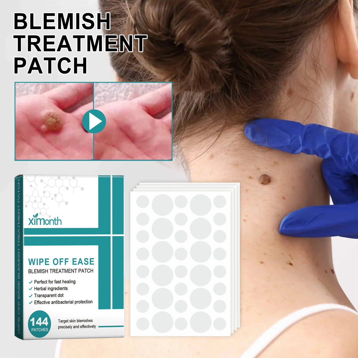 Hydrocolloid Blemish Patches - Invisible Acne Spot Treatment