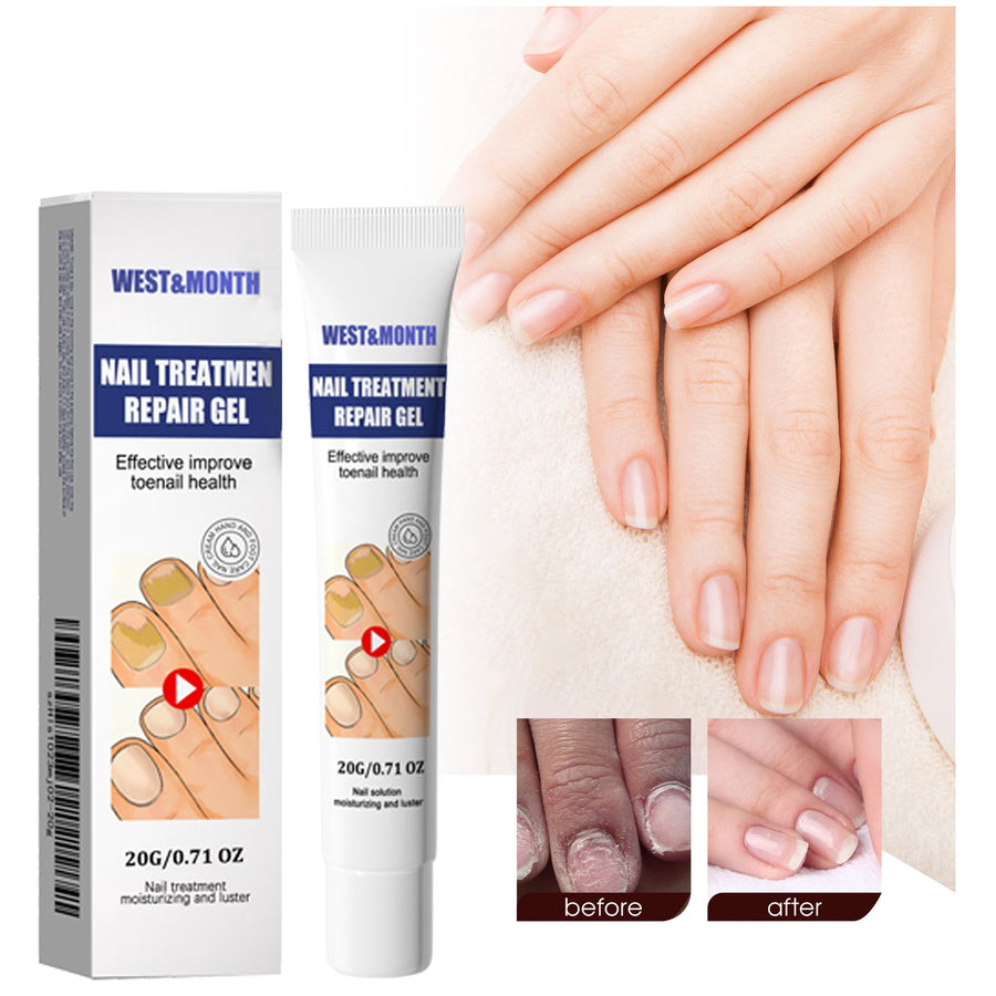 Nail Repair Gel for Damaged, Discolored Toenails