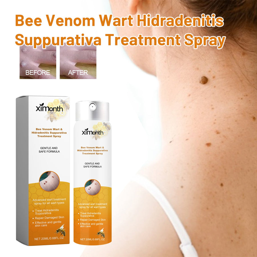 Bee Venom Wart Treatment Spray — Clear Skin in 8 Weeks