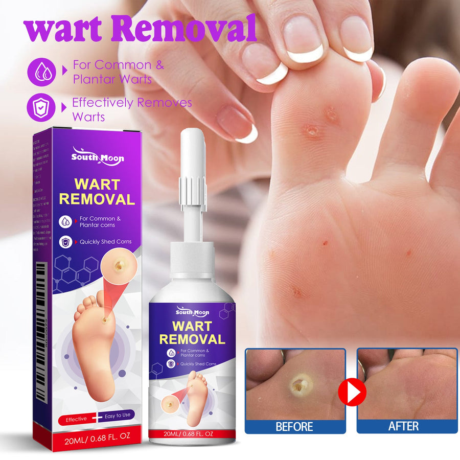 Wart & Corn Removal Liquid – Clinically Proven Botanical