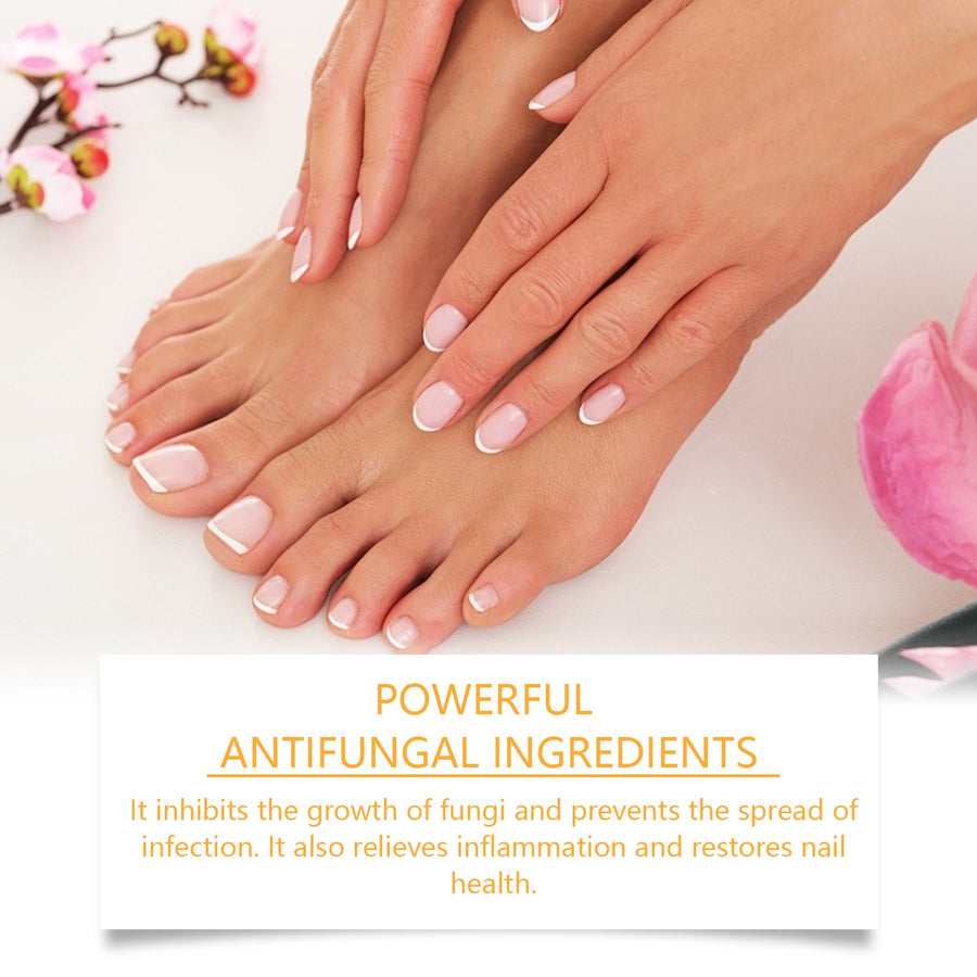 Bee Venom Nail Spray for Fungal Nail Damage Relief