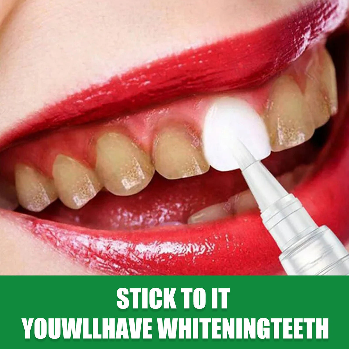 Teeth Whitening Gel Pen — Visible Whiter Teeth in 7 Days