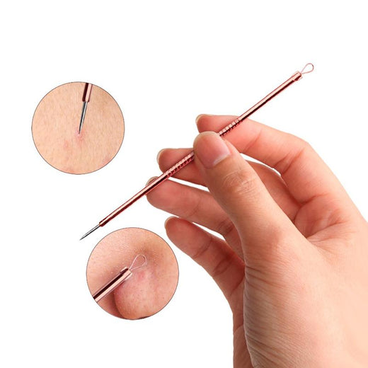 Blackhead Remover Tools for Precise At-Home Pore Care