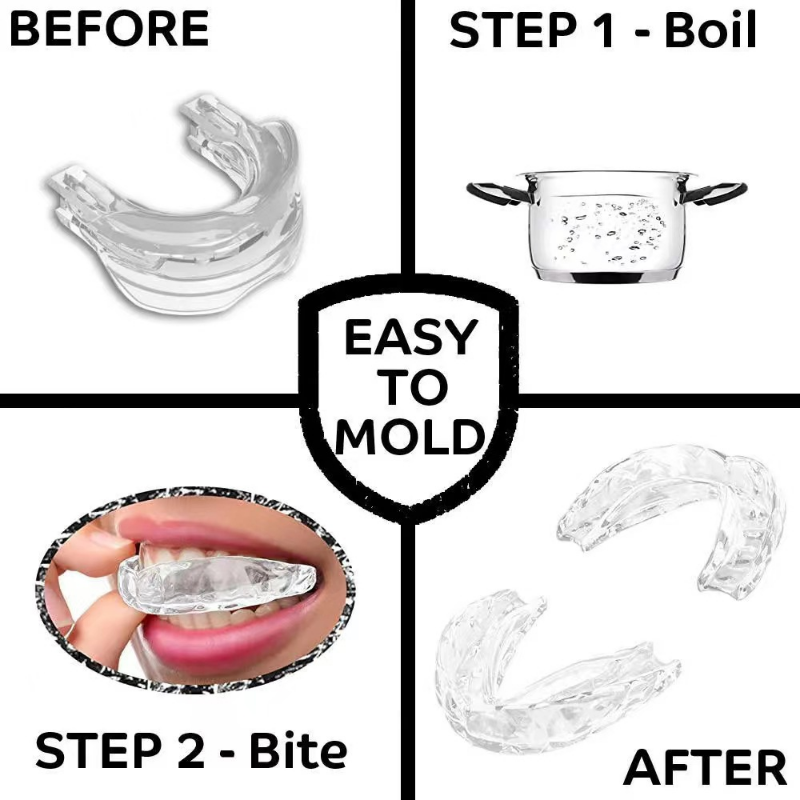 Mouth Guard for Snoring & Nighttime Teeth Grinding