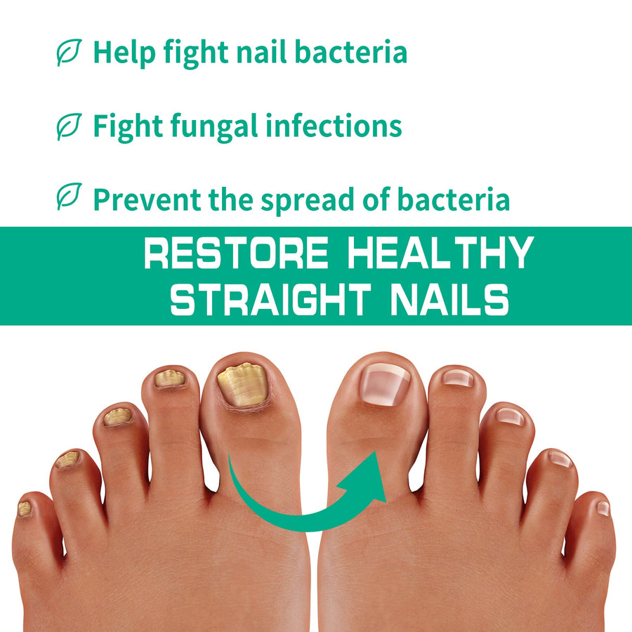 Nail Repair Cream for Fungal & Discolored Nails