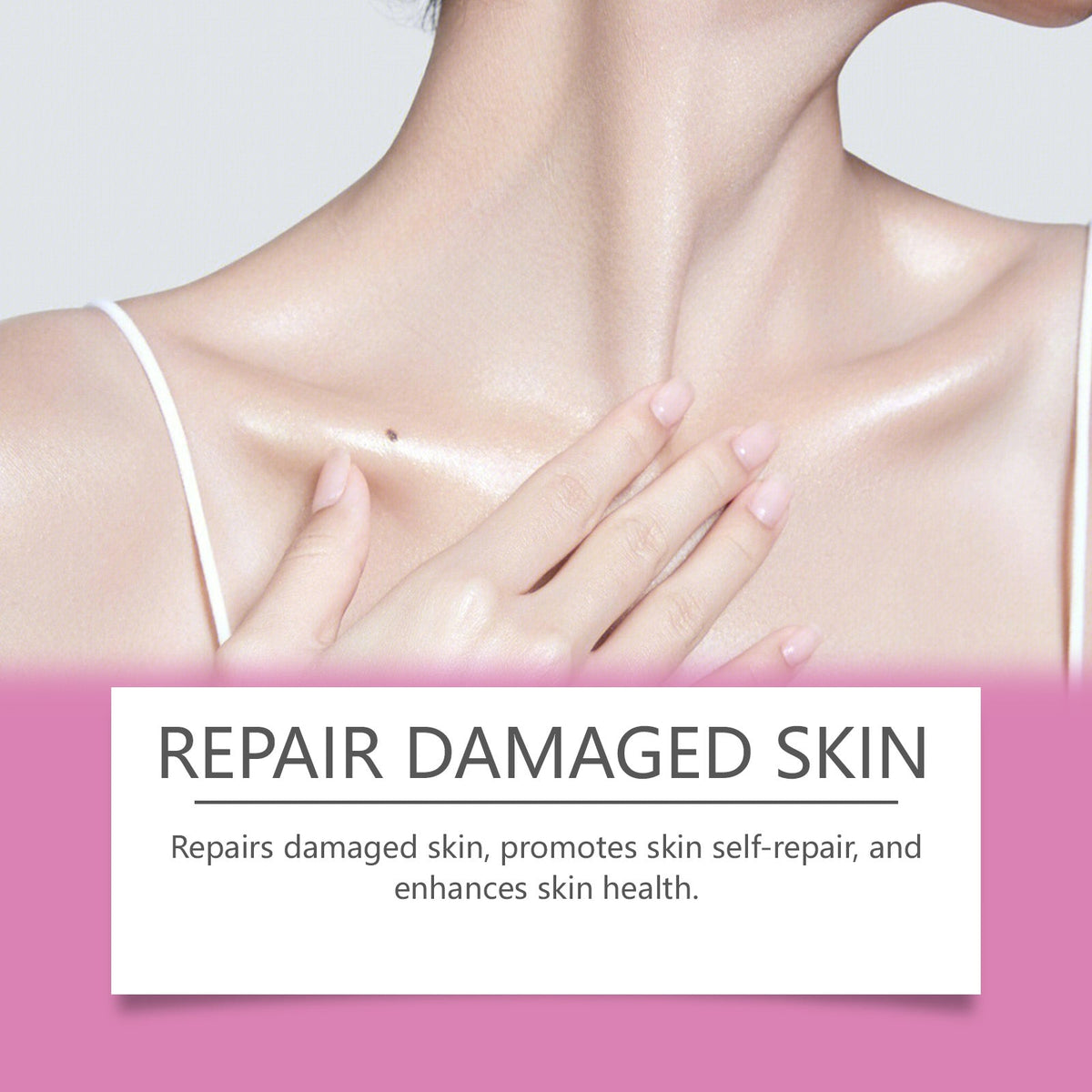 Extra Strong Peeling Oil — Fades Stretch Marks & Scars