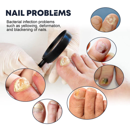 Nail Strengthening Spray for Brittle, Discolored Nails