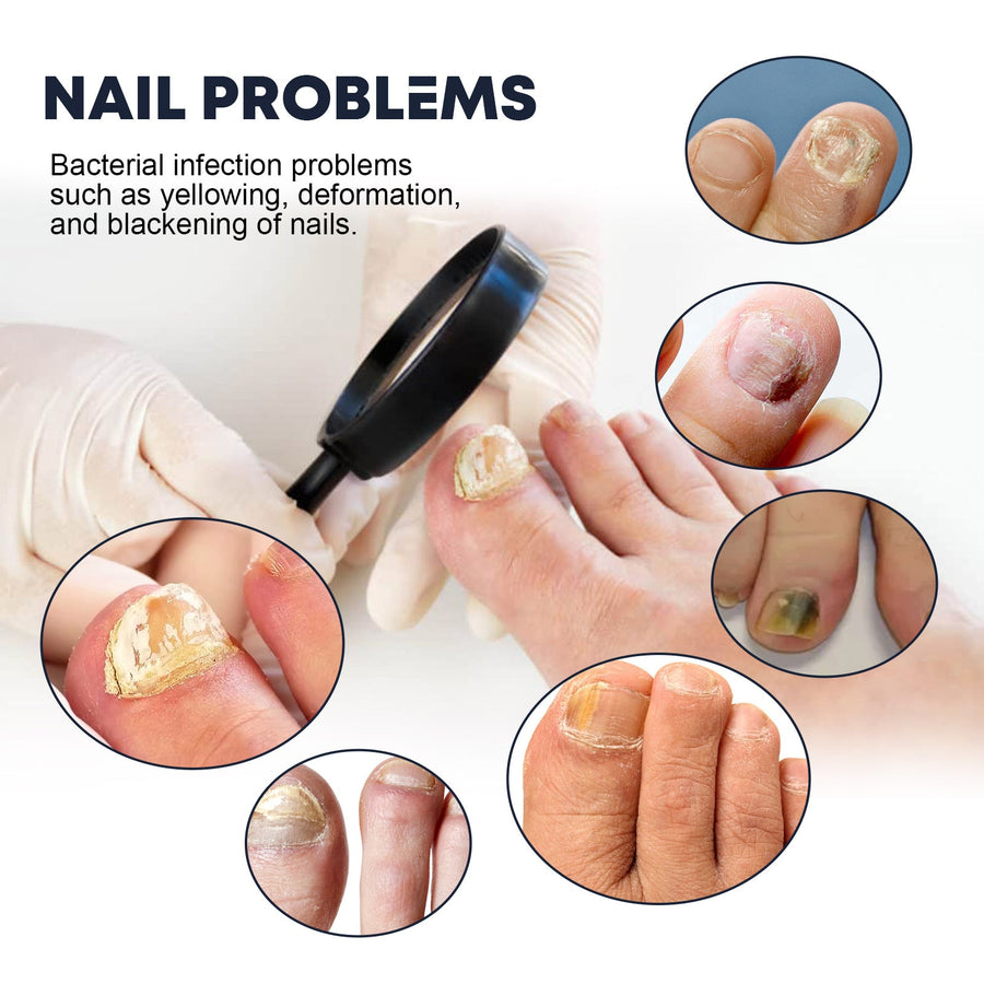 Nail Strengthening Spray for Brittle, Discolored Nails