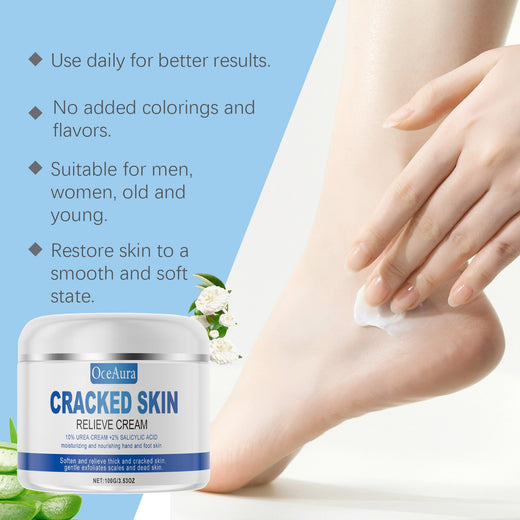 Urea Cream 10% for Cracked Heels, Hands & Elbows