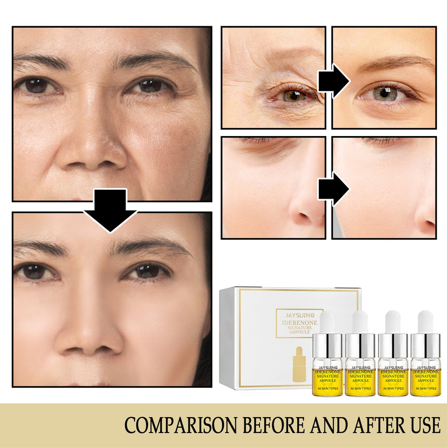 Idebenone Face Serum for Wrinkles, Dry & Dull Skin
