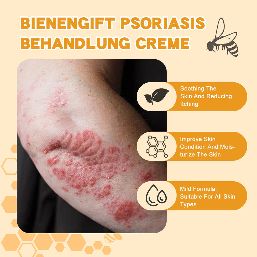 Psoriasis Cream With Bee Venom For Itch Relief