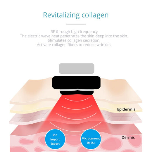 RF EMS LED Facial Device for At-Home Skin Lifting