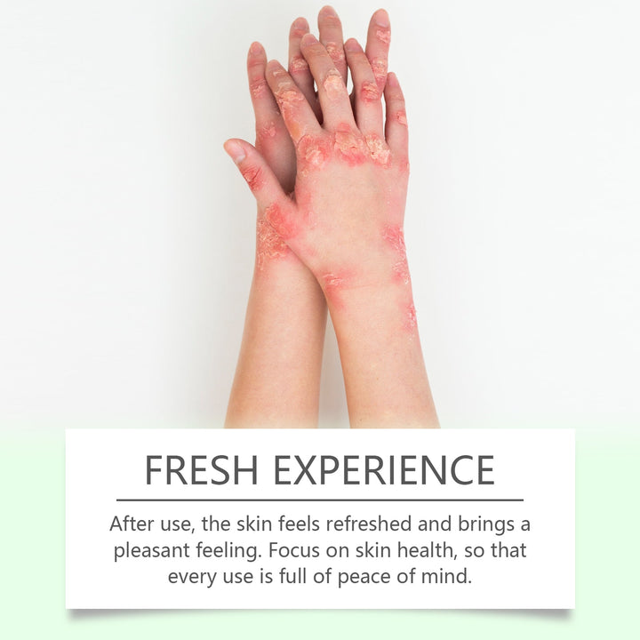 Herbal Skin Soothing Cream for Dry, Uncomfortable Skin