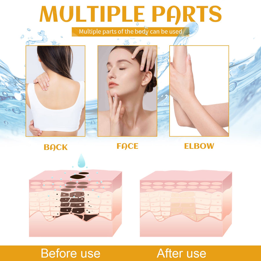 Spot Cleanser for Face & Body That Brightens Skin