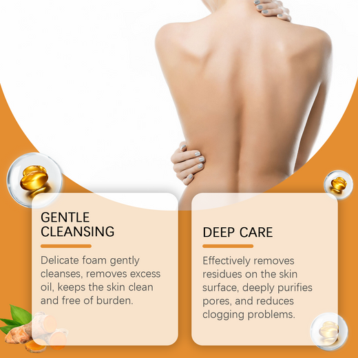 Calendula Turmeric Soap - Gentle Cleanse for Irritated Skin