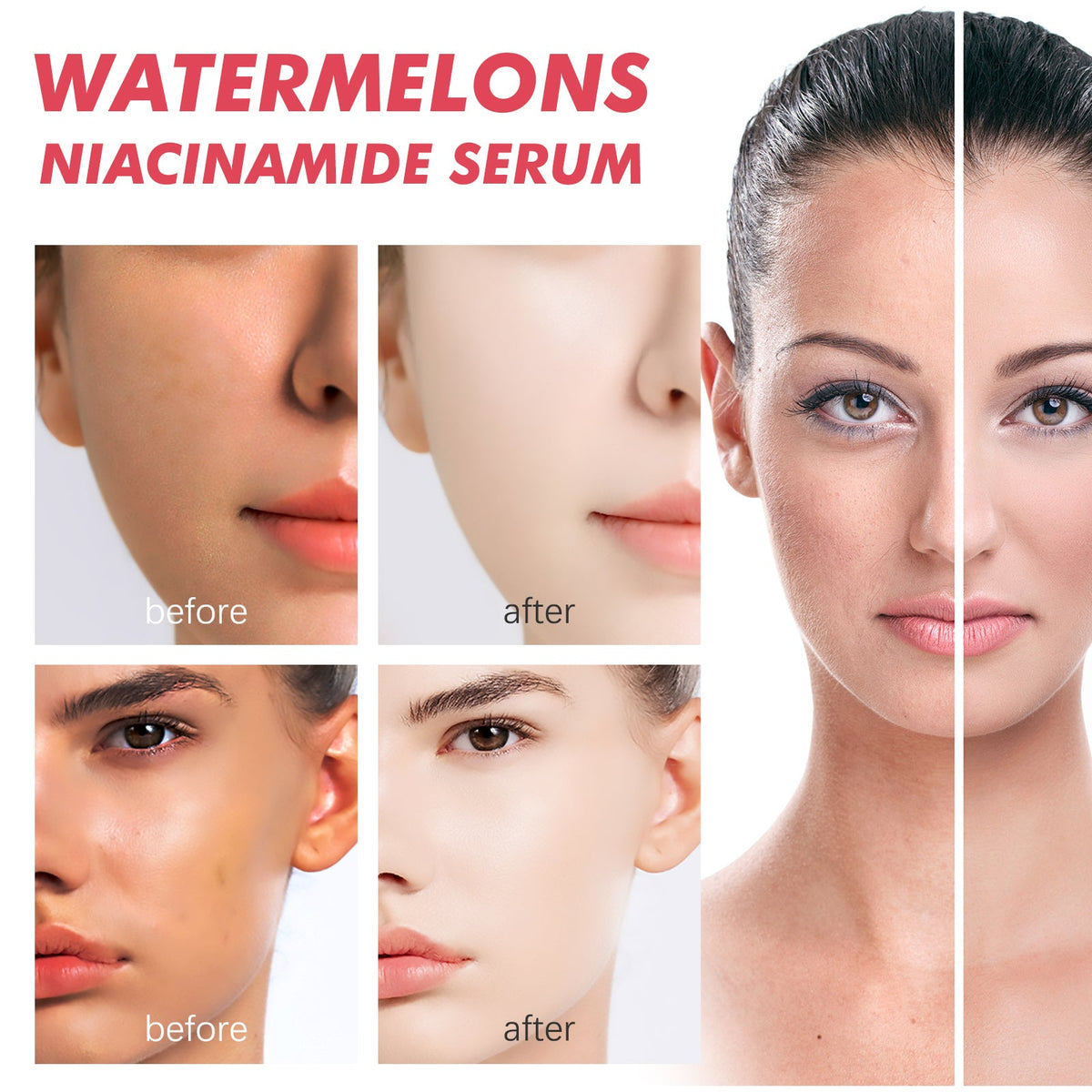 Watermelon Niacinamide Serum for Even Skin Tone