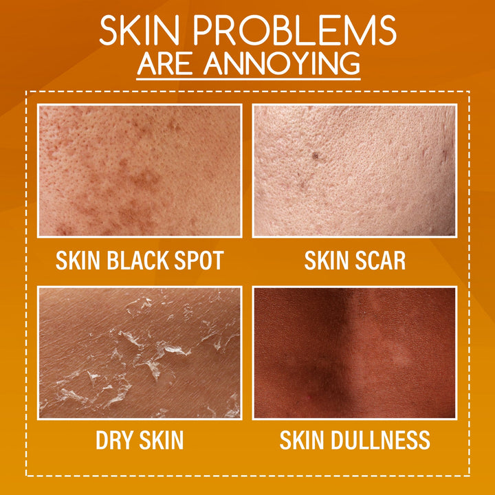 Orange Peel Body Lotion — Brighten Dark Spots & Even Skin Tone