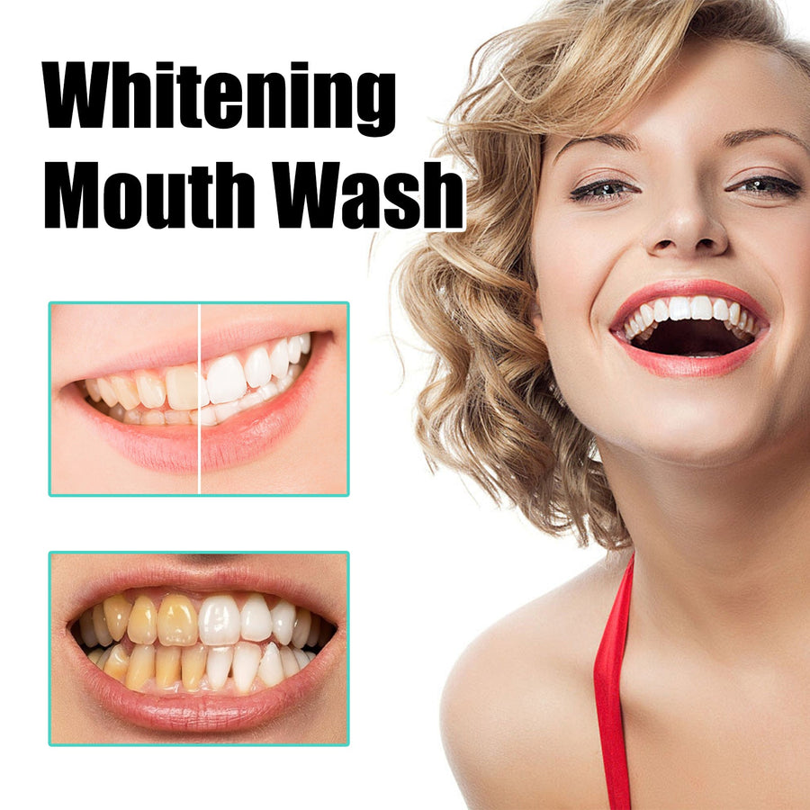 Teeth Whitening Mouthwash – Brighten Smile & Freshen Breath
