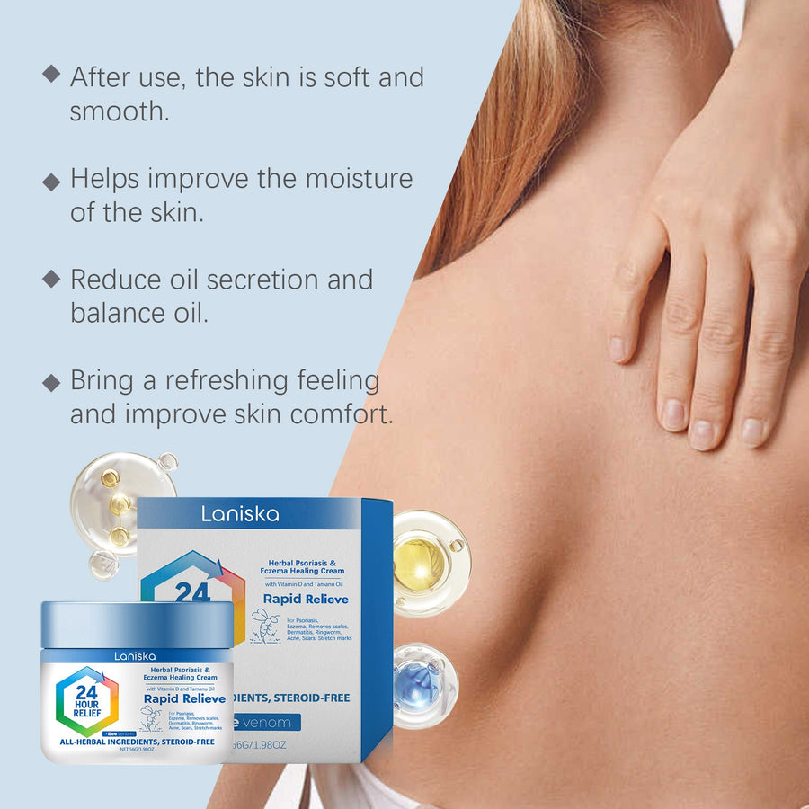 Herbal Eczema Relief Cream for Dry, Red, Irritated Skin