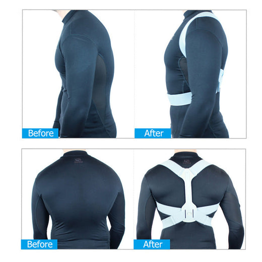 Posture Corrector Belt — Invisible Back Support for All-Day