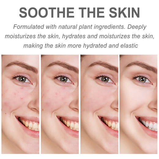Centella Hydra Cream for Redness, Fine Lines & Dryness