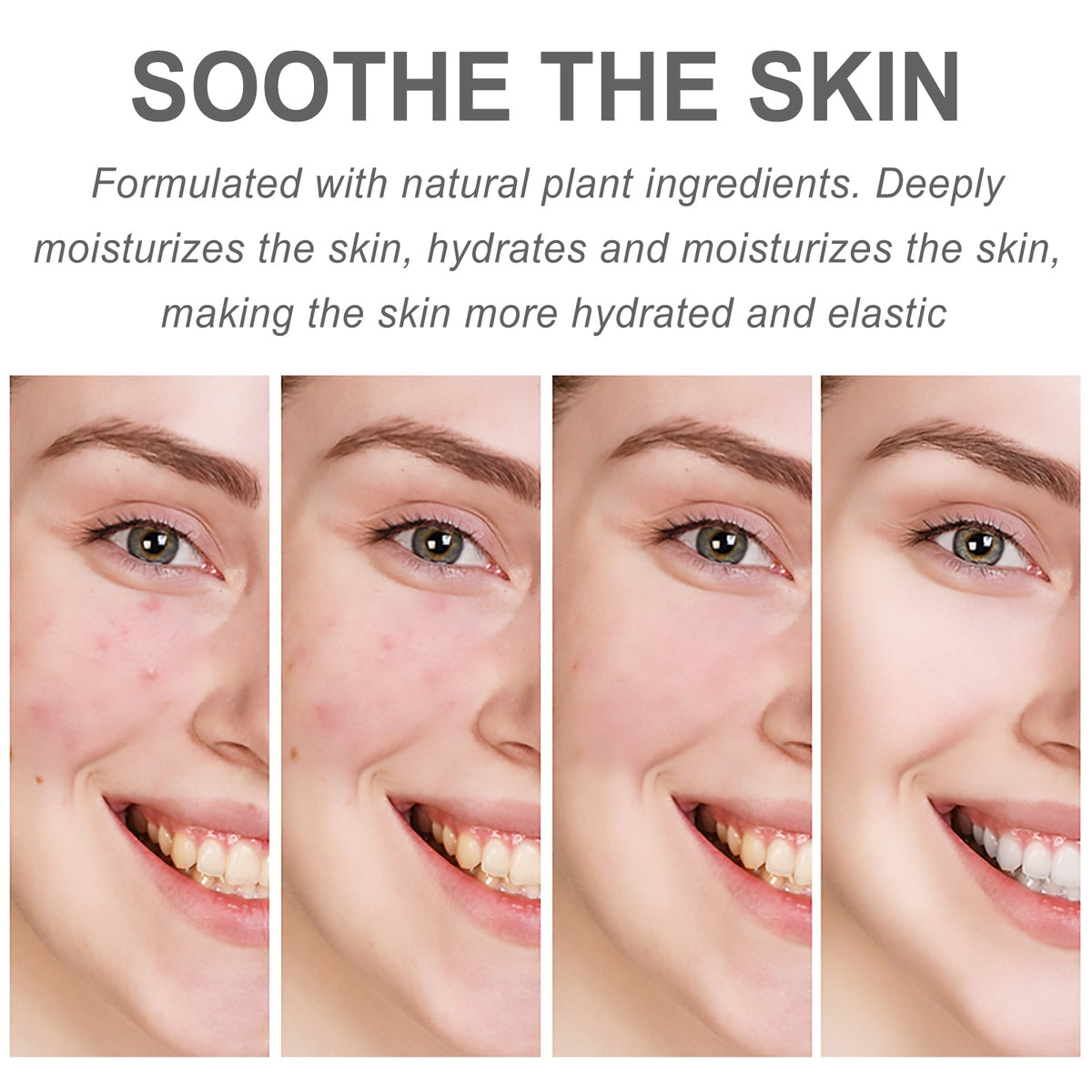 Centella Hydra Cream for Redness, Fine Lines & Dryness