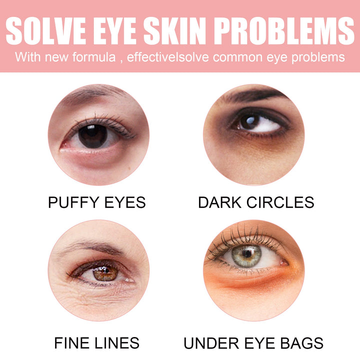 Rose Hydrogel Eye Mask 30 Pairs Dark Circle Patches