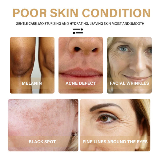 Turmeric Correction Essence for Dark Spots & Fine Lines