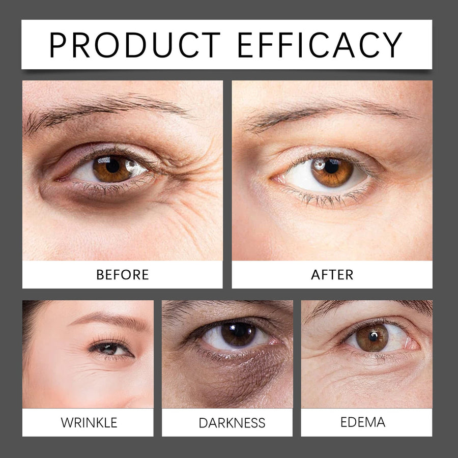 Triple Rollerball Eye Cream for Dark Circles & Puffiness