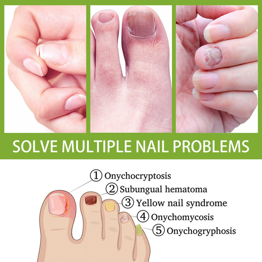 Natural Anti-Fungal Foot Soak Tablets for Nail Repair