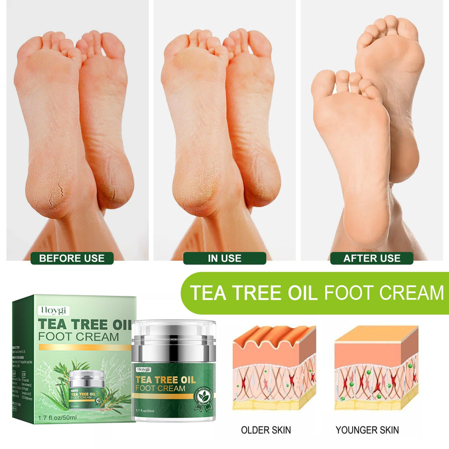 Tea Tree Foot Cream for Softer, Smoother Cracked Heels