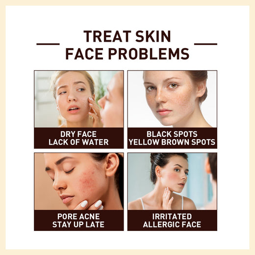Rice Anti Wrinkle Essence for Firmer Brighter Skin