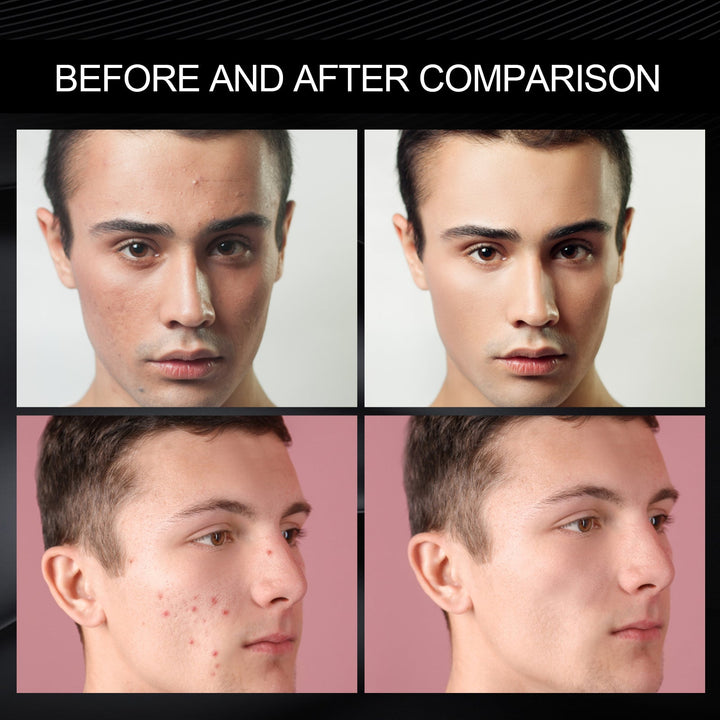 Men's Concealer Cream for Acne, Redness & Dark Circles