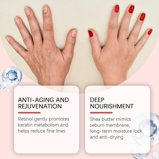 Retinol Hand Cream for Wrinkles, Age Spots & Dry Skin