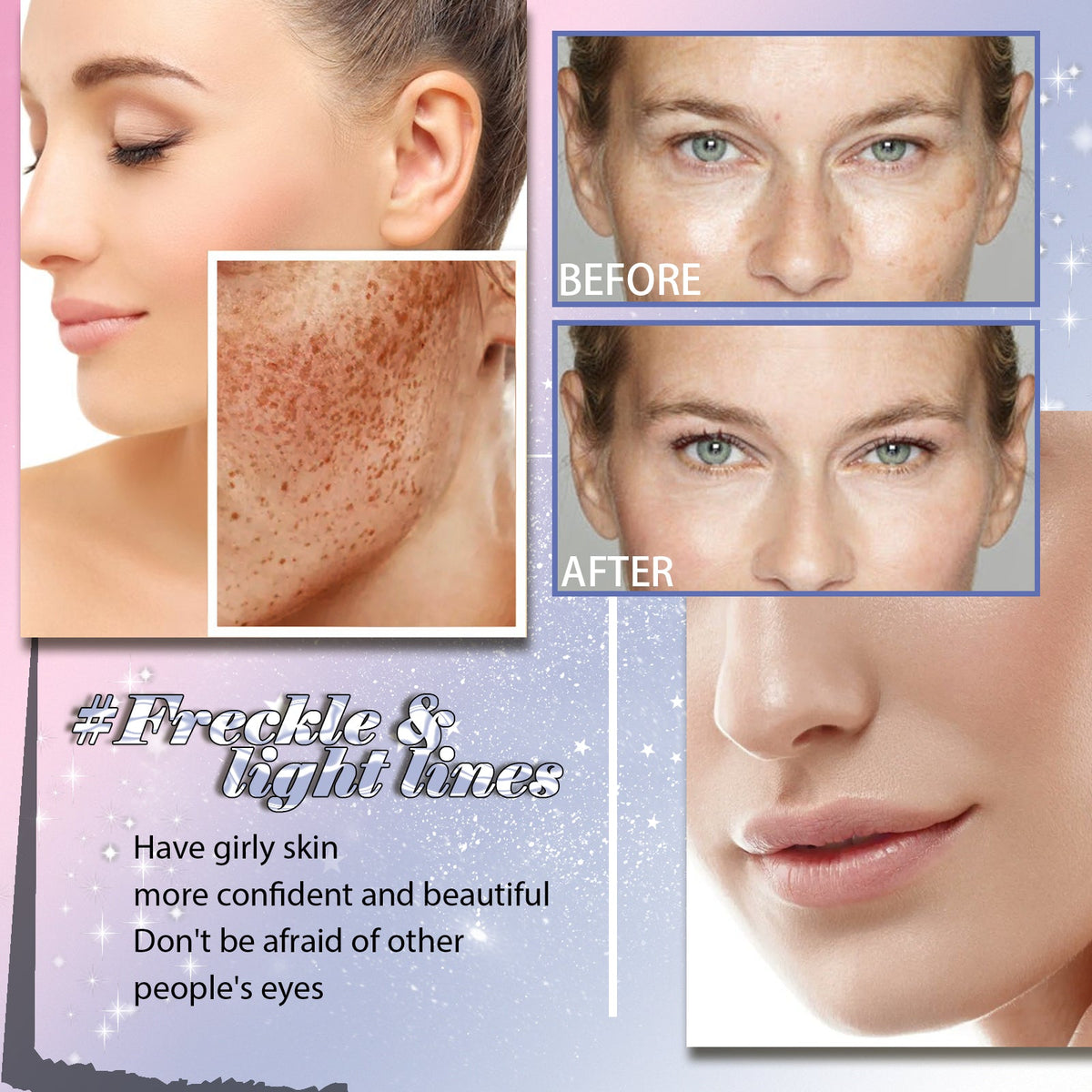 Freckle Correcting Essence with Niacinamide & Barrier Oil