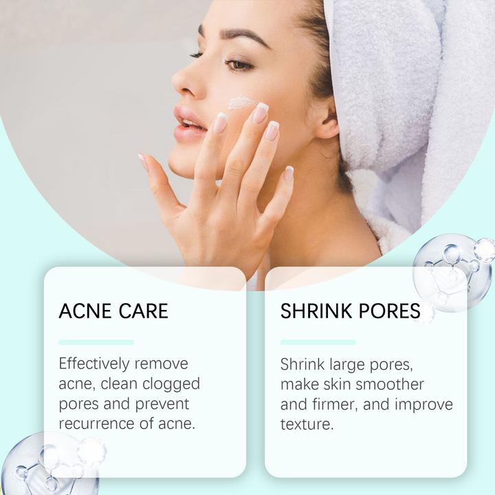 Azelaic Acid 10% Acne Cream — Clears Skin, No Dryness
