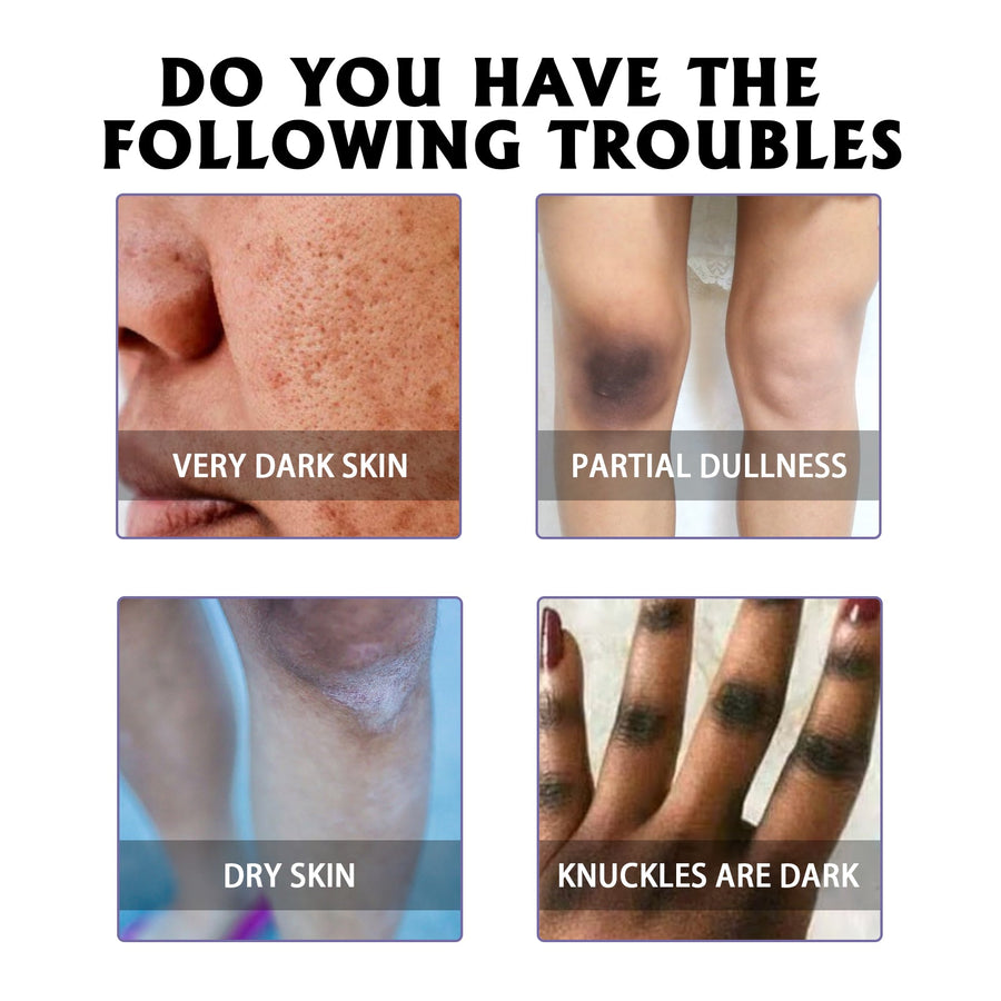 Glutathione Vitamin C Serum for Dark Spots & Elbows