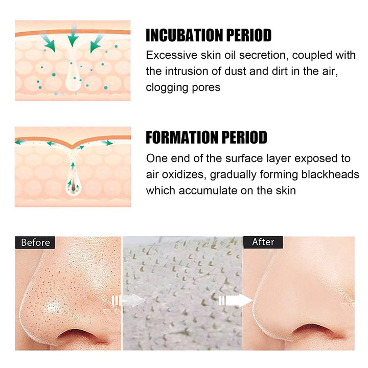 Peel-Off Blackhead Mask With Green Tea for Clear Pores