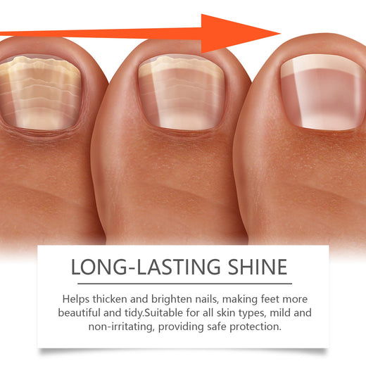 Nail Repair Patches for Overnight Nail Protection Care