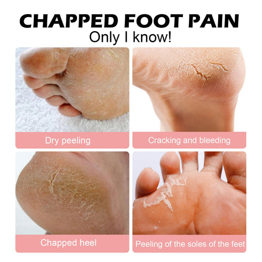 Anti-Crack Hand & Foot Cream Stick for Dry Cracked Heels