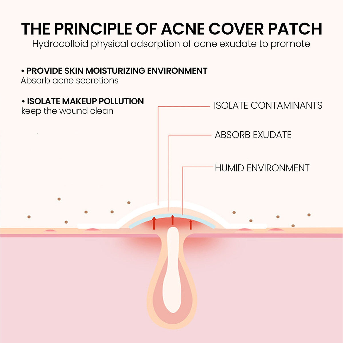 Hydrocolloid Acne Patches for Gentle Blemish Coverage