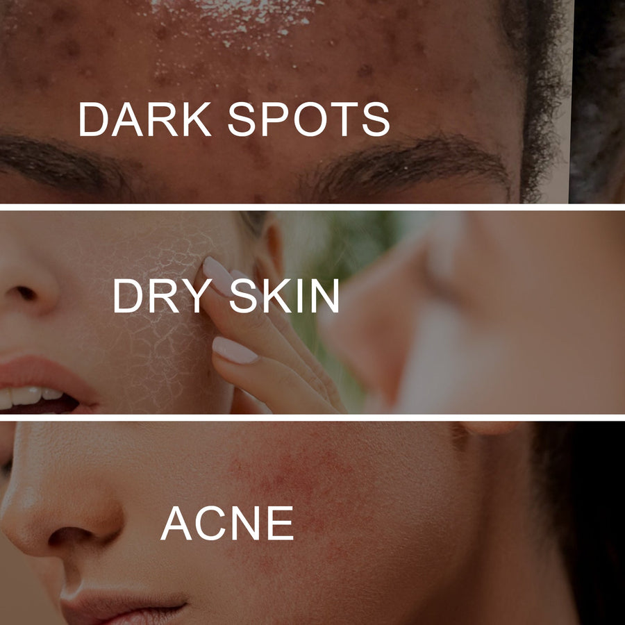 Brightening Cream for Dark Spots & Uneven Skin Tone