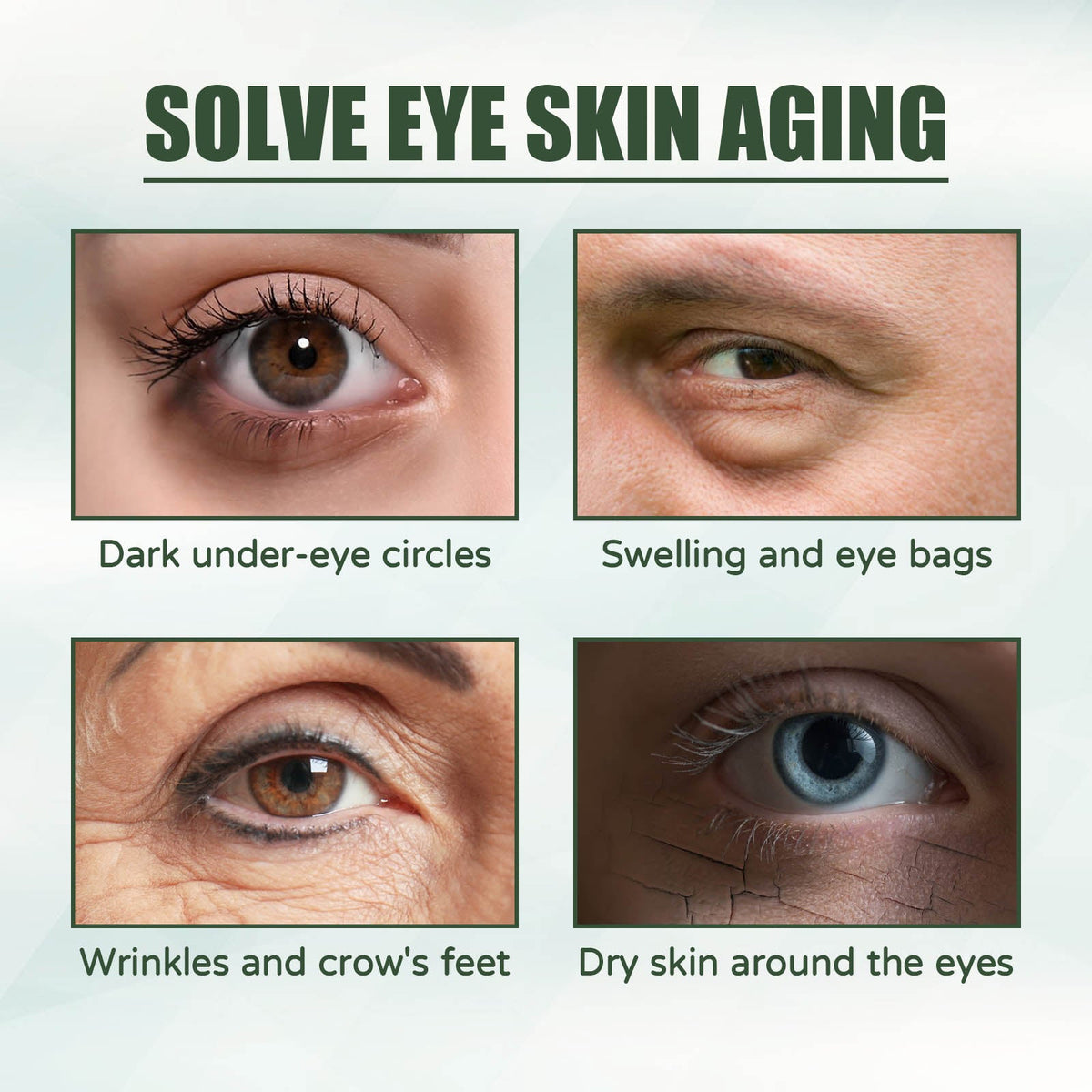 Rose Botanical Eye Cream for Fine Lines & Dark Circles